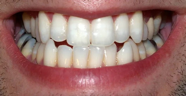After dental treatment